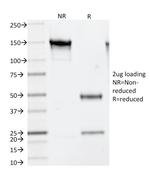 Thymidylate Synthase (5-FU Resistance Marker) Antibody in SDS-PAGE (SDS-PAGE)