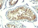 Thymidylate Synthase (5-FU Resistance Marker) Antibody in Immunohistochemistry (Paraffin) (IHC (P))