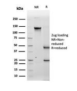 Tyrosinase Antibody in SDS-PAGE (SDS-PAGE)