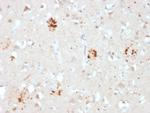 Ubiquitin (Autophagy Marker) Antibody in Immunohistochemistry (Paraffin) (IHC (P))