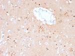 Ubiquitin (Autophagy Marker) Antibody in Immunohistochemistry (Paraffin) (IHC (P))