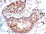 SUMO-1 Antibody in Immunohistochemistry (Paraffin) (IHC (P))