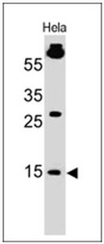 SUMO-1 Antibody in Western Blot (WB)