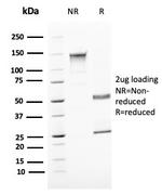 Uroplakin 1B Antibody in SDS-PAGE (SDS-PAGE)