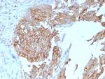 Uroplakin 1B Antibody in Immunohistochemistry (Paraffin) (IHC (P))