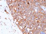 Uroplakin 1B Antibody in Immunohistochemistry (Paraffin) (IHC (P))