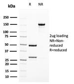 Uroplakin 1B Antibody in SDS-PAGE (SDS-PAGE)