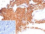 Uroplakin 1B (Urothelial Differentiation Marker) Antibody in Immunohistochemistry (Paraffin) (IHC (P))