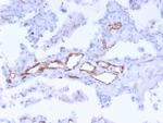 von Willebrand Factor/Factor VIII Related-Ag (Endothelial Marker) Antibody in Immunohistochemistry (Paraffin) (IHC (P))