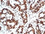XRCC5 (Ku86/Ku80) (Thyroid-Lupus Autoantigen) Antibody in Immunohistochemistry (Paraffin) (IHC (P))