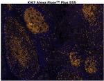 Ki-67 Antibody in Immunohistochemistry (Paraffin) (IHC (P))