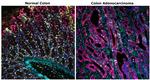 CD8 alpha Antibody in Immunohistochemistry (Paraffin) (IHC (P))