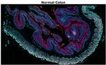 CD8 alpha Antibody in Immunohistochemistry (Paraffin) (IHC (P))