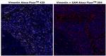 Vimentin Antibody in Immunohistochemistry (Paraffin) (IHC (P))