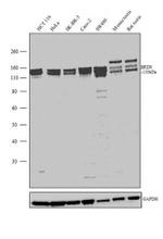 BRD8 Antibody in Western Blot (WB)