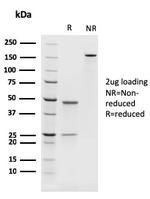PAX8 Antibody in SDS-PAGE (SDS-PAGE)