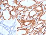 PAX8 (Renal Cell Marker) Antibody in Immunohistochemistry (Paraffin) (IHC (P))
