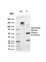 Nucleolar complex-associated protein 4-like protein (NOC4L) Antibody in SDS-PAGE (SDS-PAGE)
