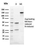 Calretinin/Calbindin 2 (Mesothelioma Marker) Antibody in SDS-PAGE (SDS-PAGE)