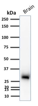 Calretinin/Calbindin 2 (Mesothelioma Marker) Antibody in Western Blot (WB)