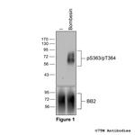 Phospho-Bombesin Receptor 2 (Ser363, Thr364) Antibody in Western Blot (WB)