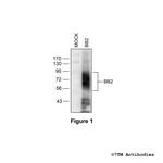 BB2, Bombesin Receptor 2 Antibody in Western Blot (WB)