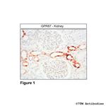 GPR87, G Protein-Coupled Receptor 87 Antibody in Immunohistochemistry (Paraffin) (IHC (P))