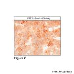 CRF1 (Corticotropin-Releasing Factor Receptor 1) Antibody in Immunohistochemistry (Paraffin) (IHC (P))