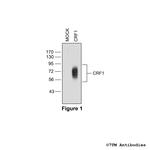 CRF1 (Corticotropin-Releasing Factor Receptor 1) Antibody in Western Blot (WB)