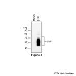 S1P1, Sphingosine 1-Phosphate Receptor 1 Antibody in Western Blot (WB)