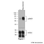 Phospho-Neurotensin Receptor 1 (Ser401) Antibody in Western Blot (WB)