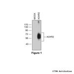 ACKR2, Atypical Chemokine Receptor 2 Antibody in Western Blot (WB)