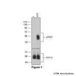 Phospho-P2Y Purinoceptor 12 (Ser323) Antibody in Western Blot (WB)