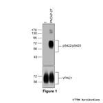 Phospho-VIP Receptor 1 (Ser422, Ser425) Antibody in Western Blot (WB)