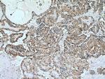 calreticulin Antibody in Immunohistochemistry (Paraffin) (IHC (P))