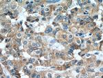 calreticulin Antibody in Immunohistochemistry (Paraffin) (IHC (P))