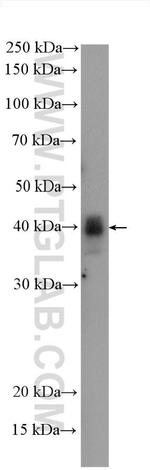 MAP2K3 Antibody in Western Blot (WB)