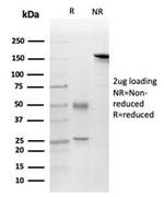 FGF23 (Fibroblast Growth Factor 23) Antibody in Immunoelectrophoresis (IE)