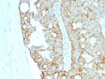 MAML2 (Mastermind Like Transcriptional Coactivator 2) Antibody in Immunohistochemistry (Paraffin) (IHC (P))