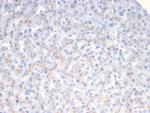 ABCB11/BSEP Antibody in Immunohistochemistry (Paraffin) (IHC (P))