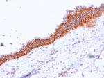 MRP3 (Multidrug Resistance-Associated Protein 3) Antibody in Immunohistochemistry (Paraffin) (IHC (P))