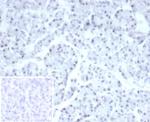 PHOX2B Antibody in Immunohistochemistry (Paraffin) (IHC (P))