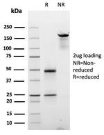 Cyclin D2 Antibody in SDS-PAGE (SDS-PAGE)