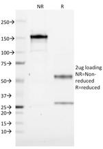 CD1a/HTA1 (Mature Langerhans Cells Marker) Antibody in SDS-PAGE (SDS-PAGE)