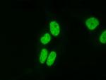 Histone H4K20me3 Antibody in Immunocytochemistry (ICC/IF)