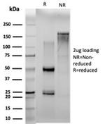 N myc (and STAT) Interactor/NMI Antibody in SDS-PAGE (SDS-PAGE)
