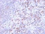 RCAS1/Estrogen Receptor Binding Site Associated, Antigen 9 Antibody in Immunohistochemistry (Paraffin) (IHC (P))