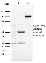 RCAS1/Estrogen Receptor Binding Site Associated, Antigen 9 Antibody in SDS-PAGE (SDS-PAGE)