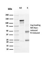 CD4 Antibody in SDS-PAGE (SDS-PAGE)