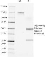 CD7 (T-Cell Leukemia Marker) Antibody in SDS-PAGE (SDS-PAGE)